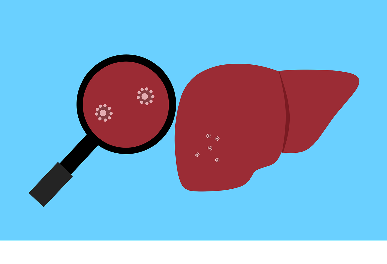 不明肝炎怎么办 肝炎不明显症状有哪些