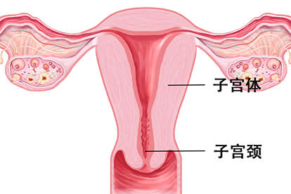 子宫形状图