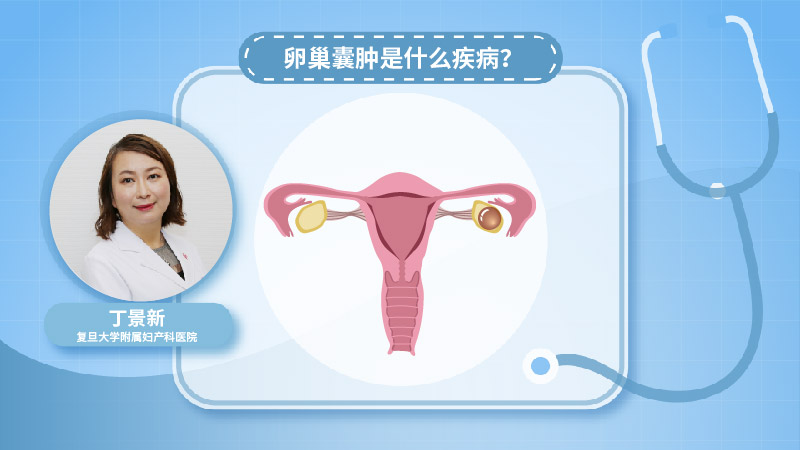 卵巢囊肿是什么疾病？