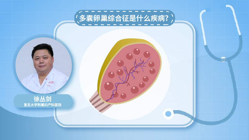 多囊卵巢综合征是什么疾病？