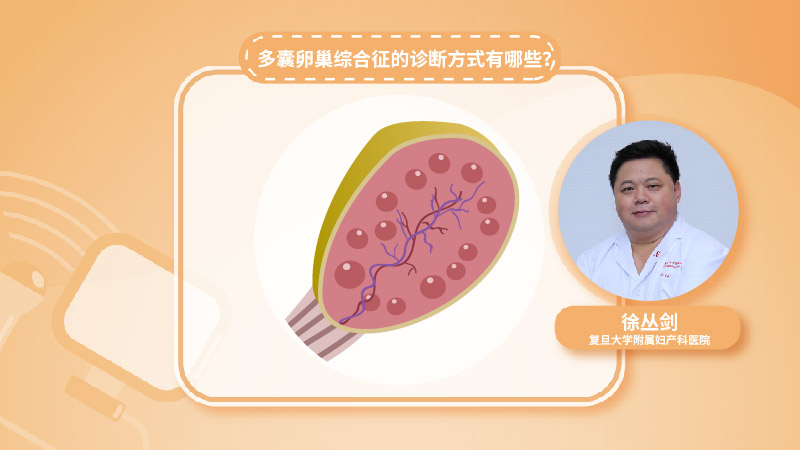 多囊卵巢综合征的诊断方式有那些？