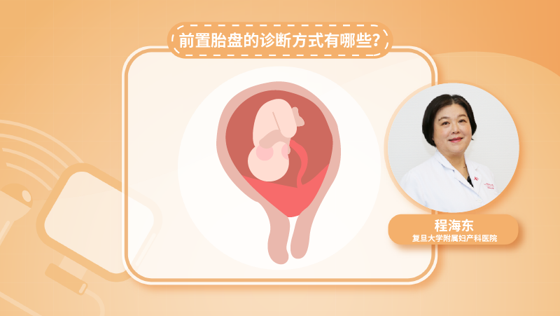 前置胎盘的诊断方式有哪些？