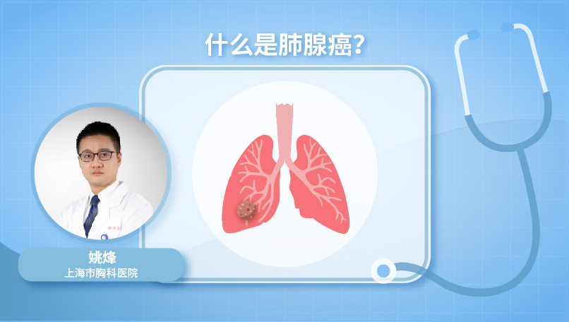什么是肺腺癌？