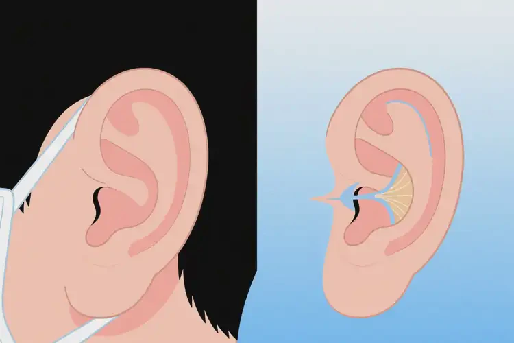 2025年甘肃定西做招风耳矫正大概多少钱(图4)