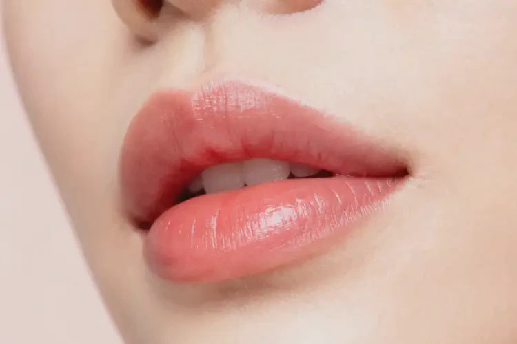 2025年甘肃白银做玻尿酸丰唇一般多少钱(图2)