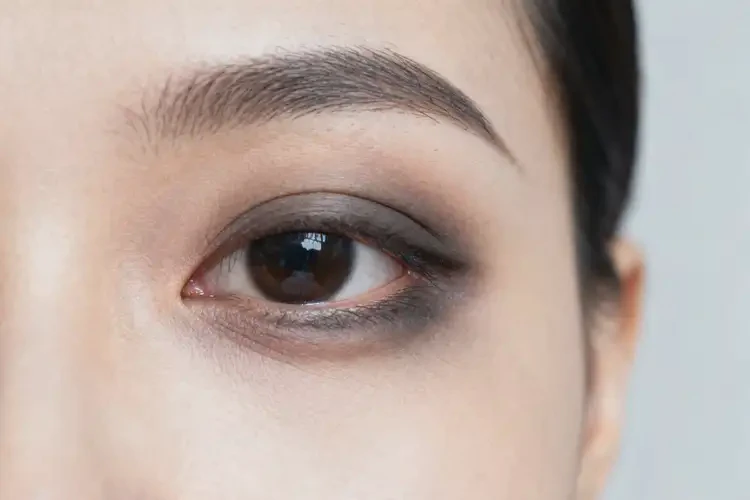 2025年广东云浮做激光淡化黑眼圈一般多少钱(图3)