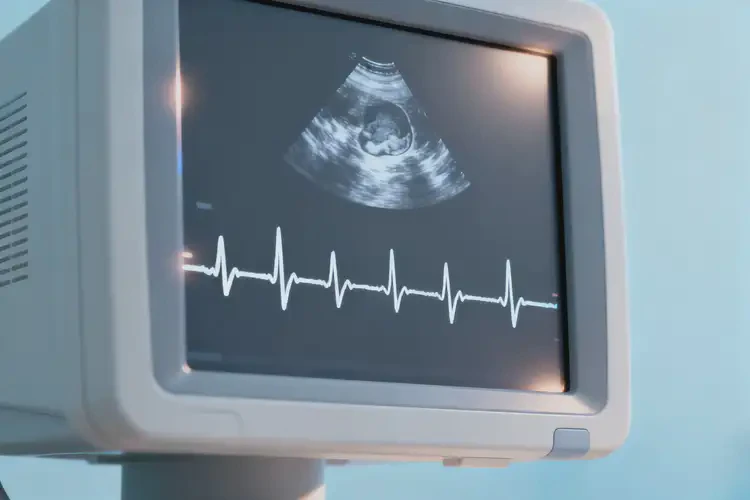 懷孕四十多天寶寶心跳153正常嗎(圖3)