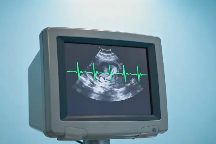 懷孕四十多天寶寶心跳153正常嗎(圖4)