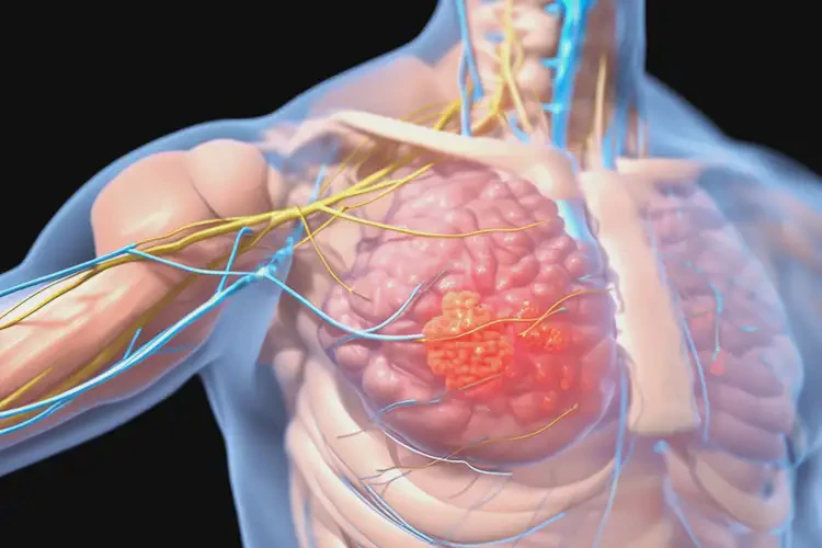 廣東深圳康復(fù)科帶狀皰疹后神經(jīng)痛(圖2)