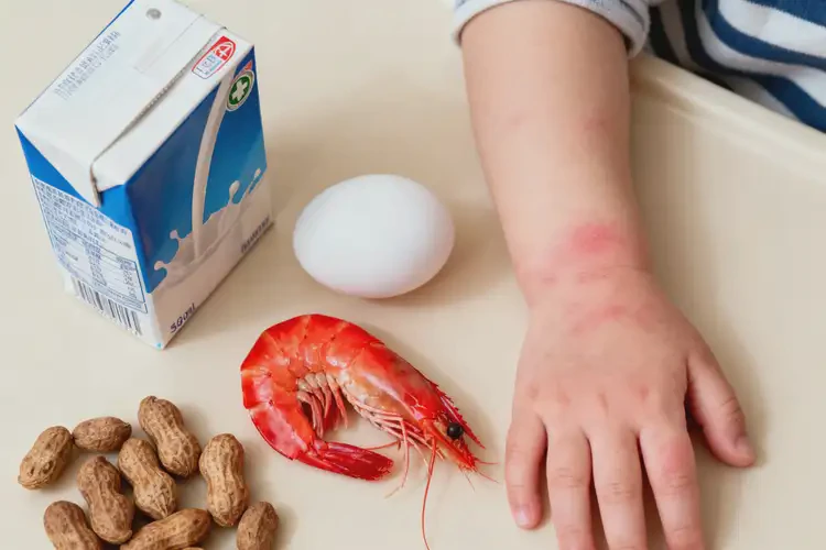 幼兒手上偶爾長濕疹哪些不太適合吃(圖4)