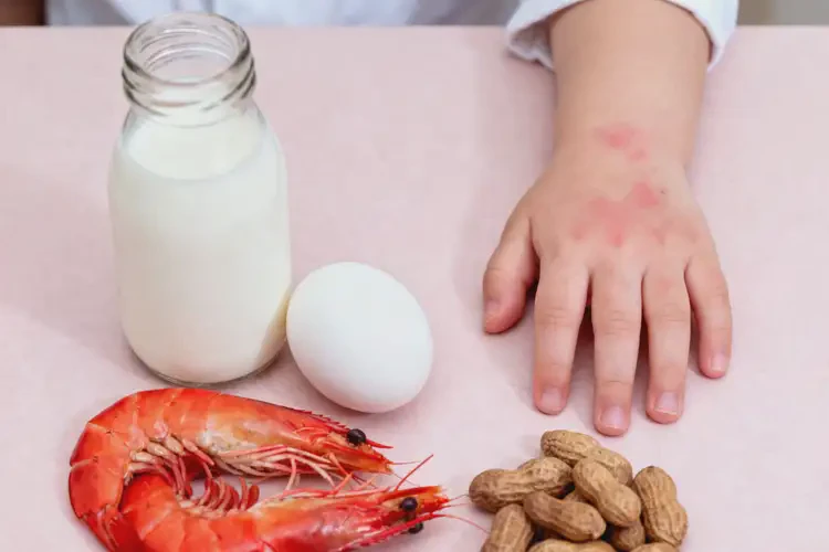 幼兒手上偶爾長濕疹哪些不太適合吃(圖3)