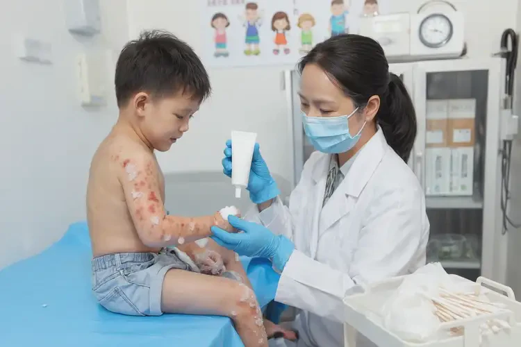 幼儿全身经常长湿疹会自己好吗(图2)