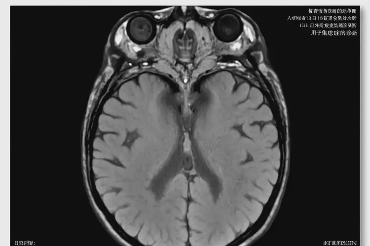重庆去医院检查轻度焦虑贵不贵(图1)