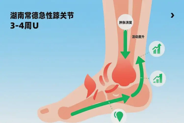 湖南常德康復(fù)科看踝關(guān)節(jié)痛要多久(圖3)