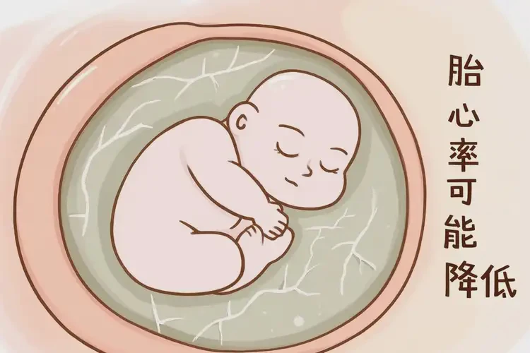 孕38周5天胎心85怎么回事(圖2)