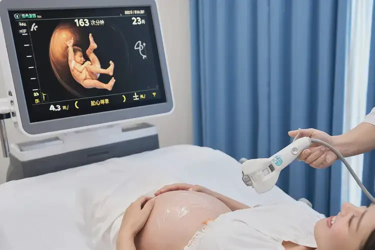 孕23周胎心率163怎么回事(圖4)