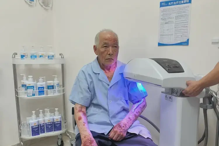 老年人全身有濕疹可不可以自愈(圖1)