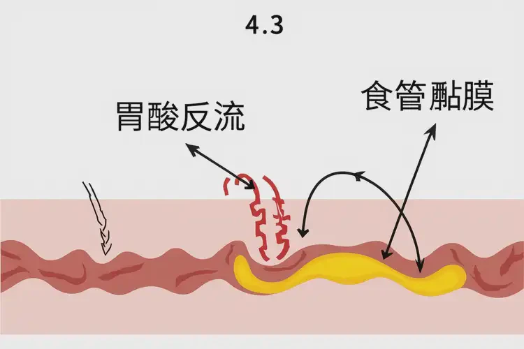 胃灼熱喝蓮子百合銀耳湯可以下火嗎(圖4)