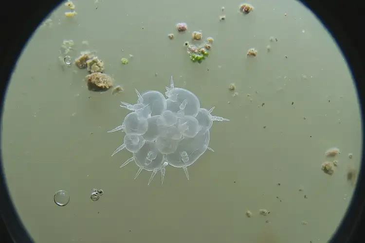 49歲男人野外游泳感染阿米巴蟲的幾率是多少(圖3)