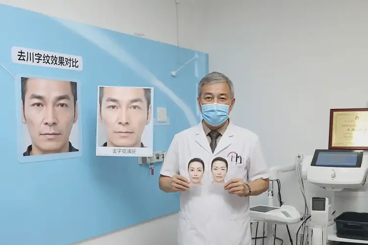 2025年湖南懷化注射去川字紋哪家做的好(圖2)
