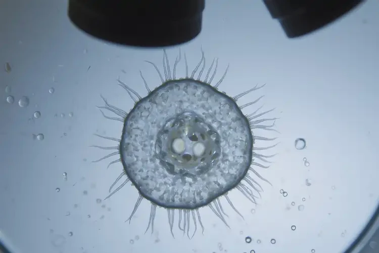 16歲男孩游泳感染阿米巴寄生蟲(chóng)有什么癥狀(圖1)