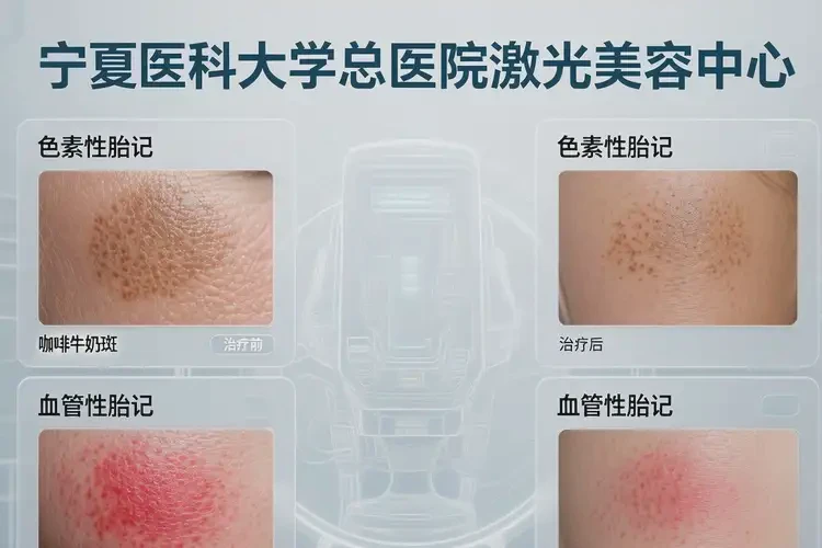 2025年寧夏中衛(wèi)手術(shù)去胎記哪家做的好(圖2)
