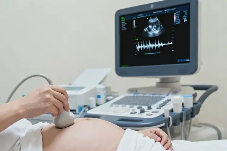 孕31周胎心率94寶寶還能要嗎(圖3)