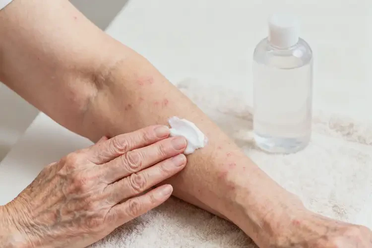 老年人手臂經(jīng)常長濕疹會自己好嗎(圖3)