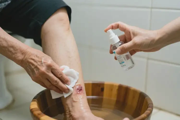 老年人小腿出現(xiàn)濕疹治療方法(圖2)