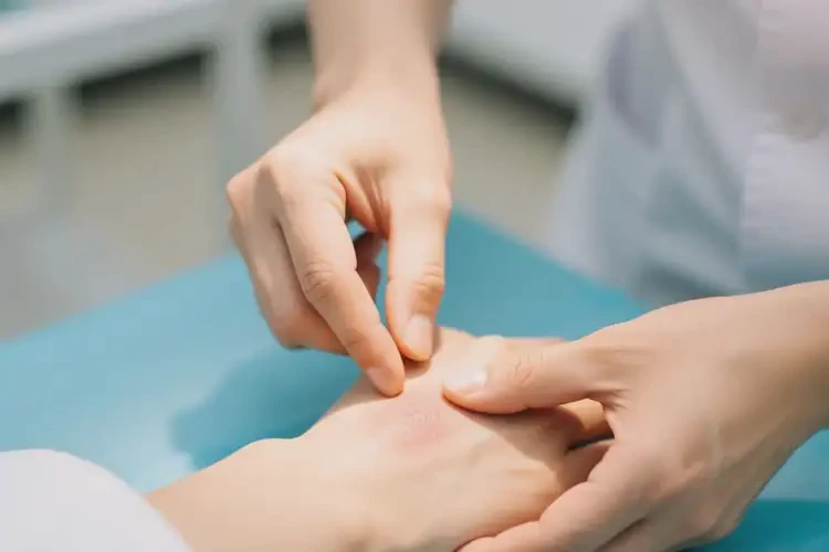 山東德州哪里看玫瑰痤瘡最好(圖3)