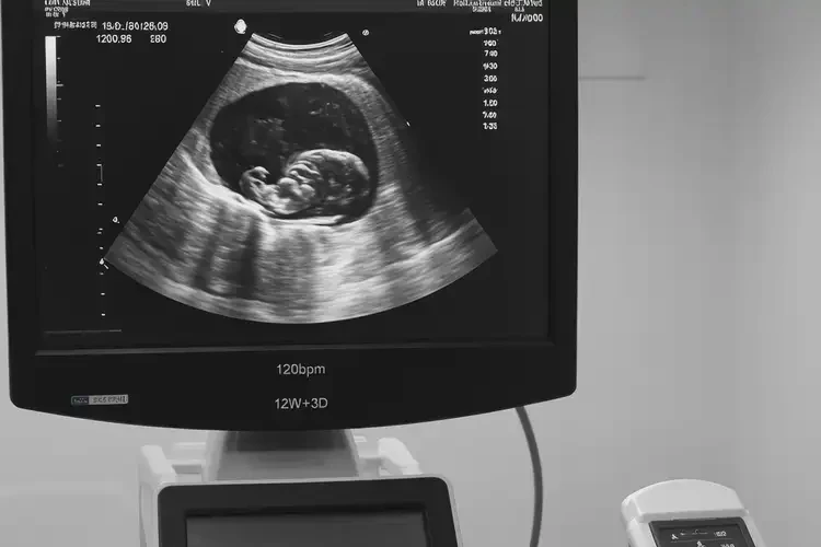 怀孕90天胎心90左右还能保住吗(图3)