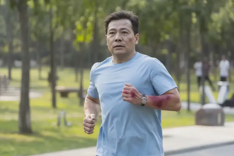 男性手臂容易起濕疹最簡單自愈方法(圖1)