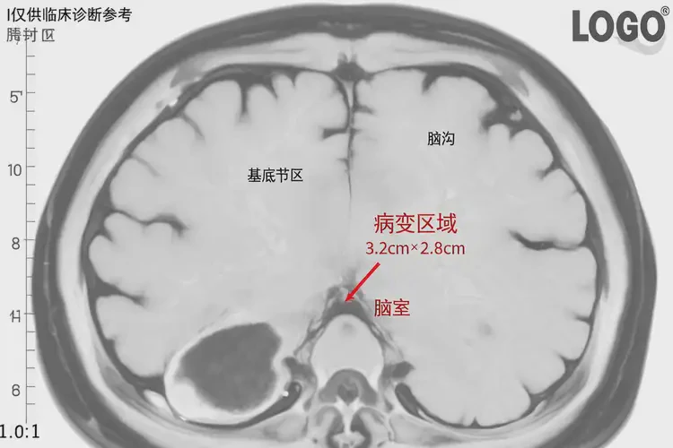 山東濟(jì)寧去醫(yī)院檢查躁狂癥一般是多少錢(圖1)