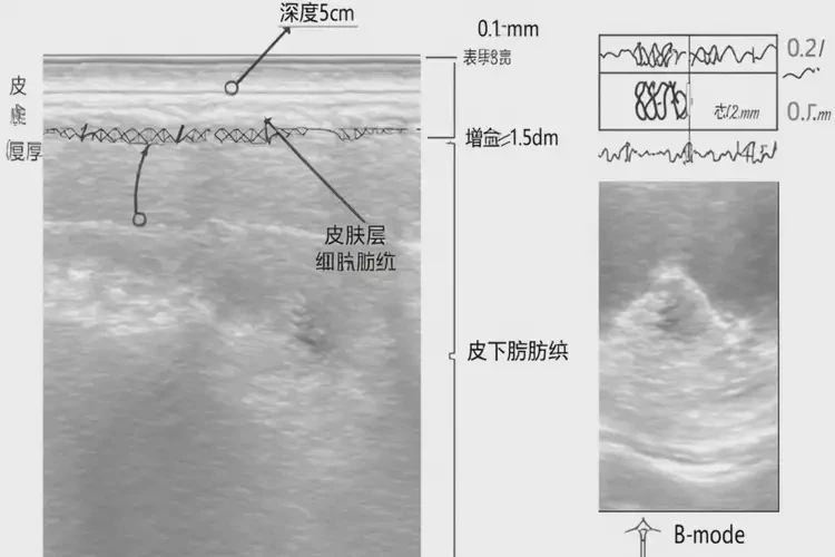 玫瑰痤瘡如何檢查(圖1)