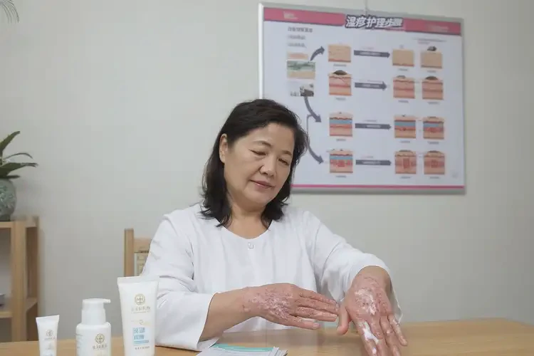 大學(xué)生面部起濕疹不管它會自己痊愈嗎(圖2)