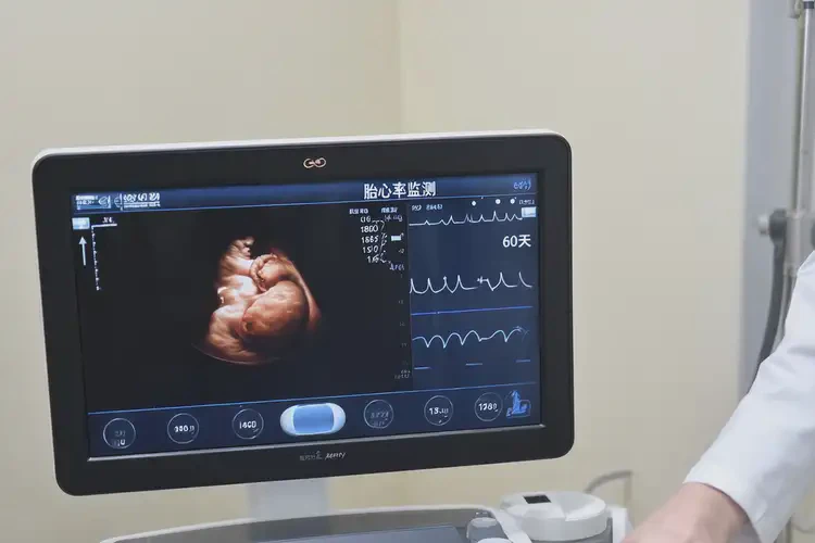 懷孕60天胎心180多還要保胎嗎(圖4)