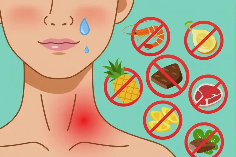 脖子偶爾長濕疹有什么吃了會加重病情(圖1)