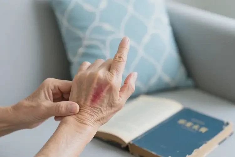 老人身上容易起濕疹能靠自己自愈嗎(圖1)