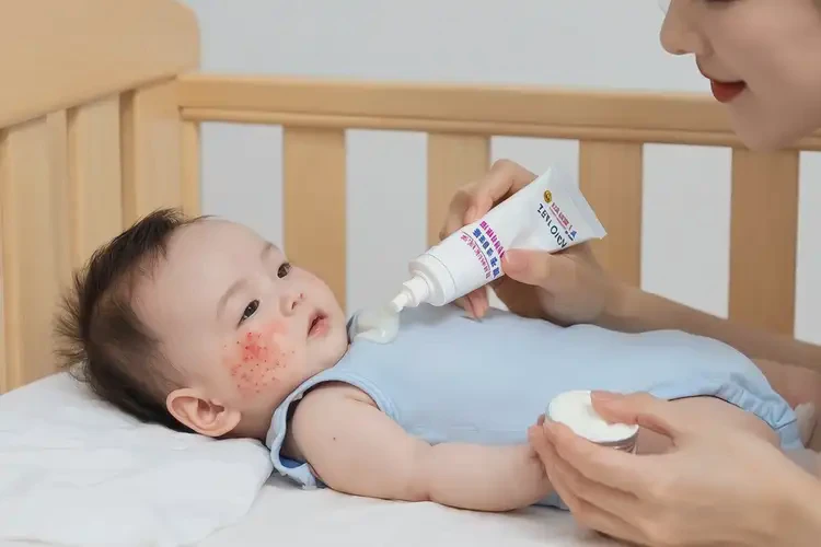 嬰兒脖子上容易長濕疹不管它會自己好嗎(圖2)