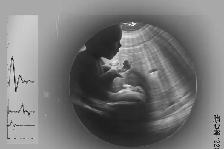 孕3周3天胎心100左右有危險嗎(圖1)