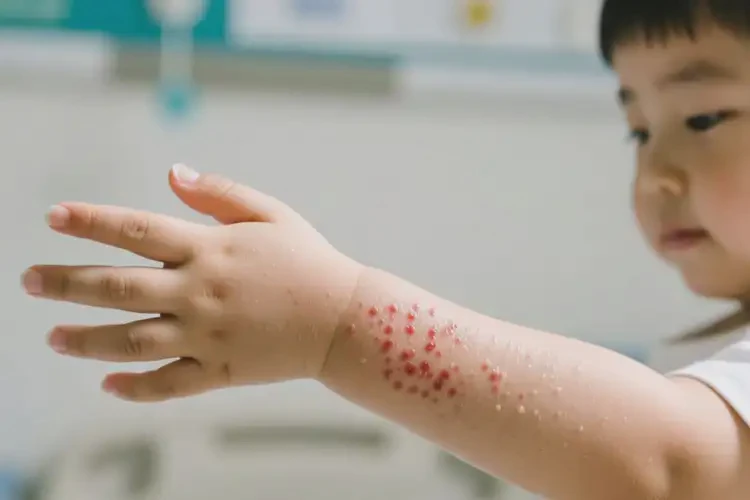 孩子手臂上容易起濕疹能不能徹底自愈(圖3)
