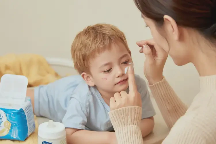 幼兒面部有濕疹能徹底自愈嗎(圖3)