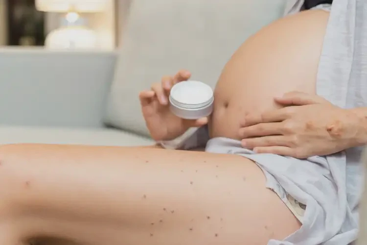 孕婦大腿長濕疹能靠自己自愈嗎(圖2)