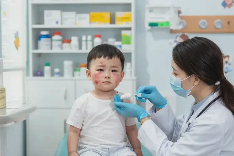 幼兒臉上經(jīng)常長濕疹可以徹底自愈嗎(圖3)