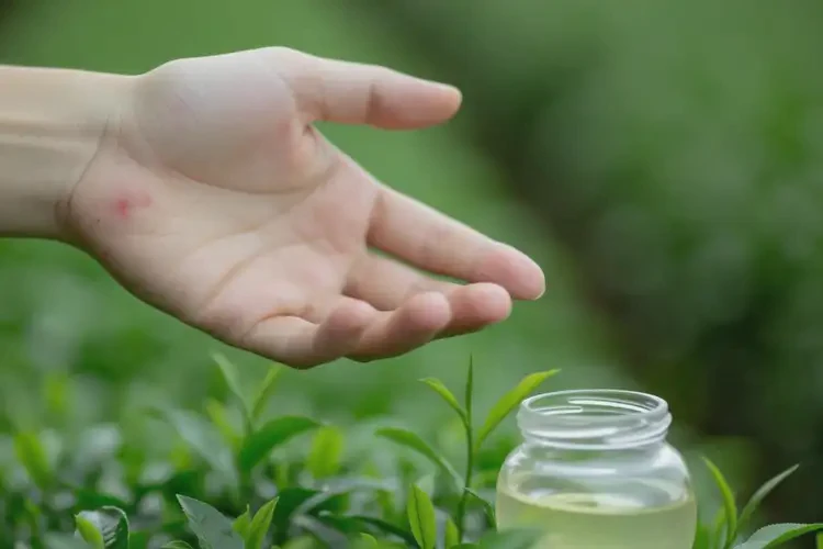 男性手上長濕疹最簡單自愈方法(圖3)