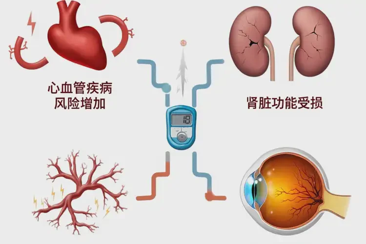 男人餐后血糖12點(diǎn)4正常嗎(圖2)