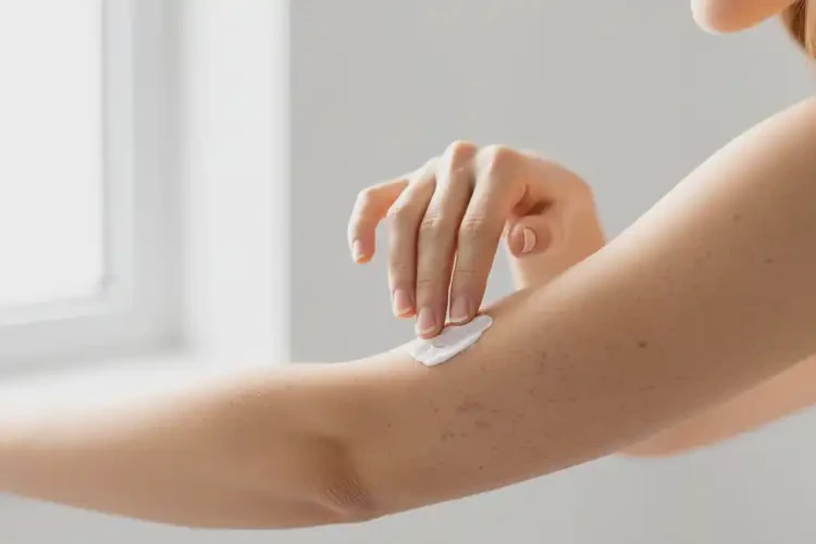 女人手臂上容易起湿疹治疗方法(图1)