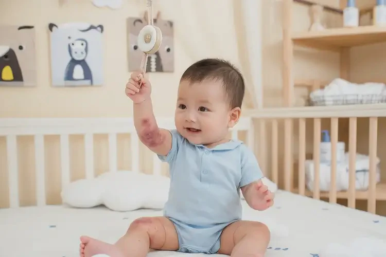 嬰兒手臂上出現(xiàn)濕疹可以徹底自愈嗎(圖1)