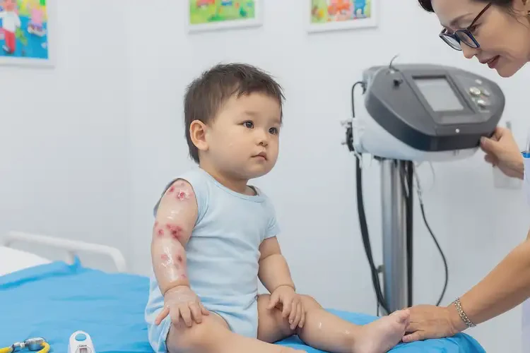 幼儿手臂上偶尔长湿疹康复的全过程(图1)