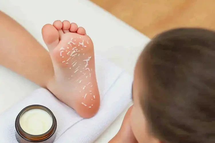 小兒腳上容易長濕疹能自愈嗎(圖2)